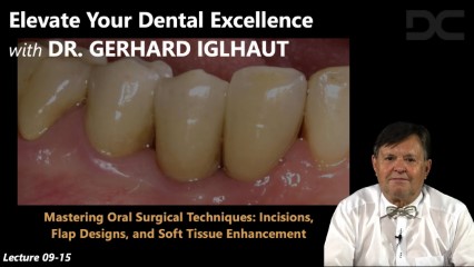 Mastering oral surgical techniques: Incisions, flap designs, and soft tissue enhancement